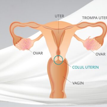 1688476653_index.jpeg Cancerul de col uterin poate fi prevenit! Ce este cancerul de col uterin?
