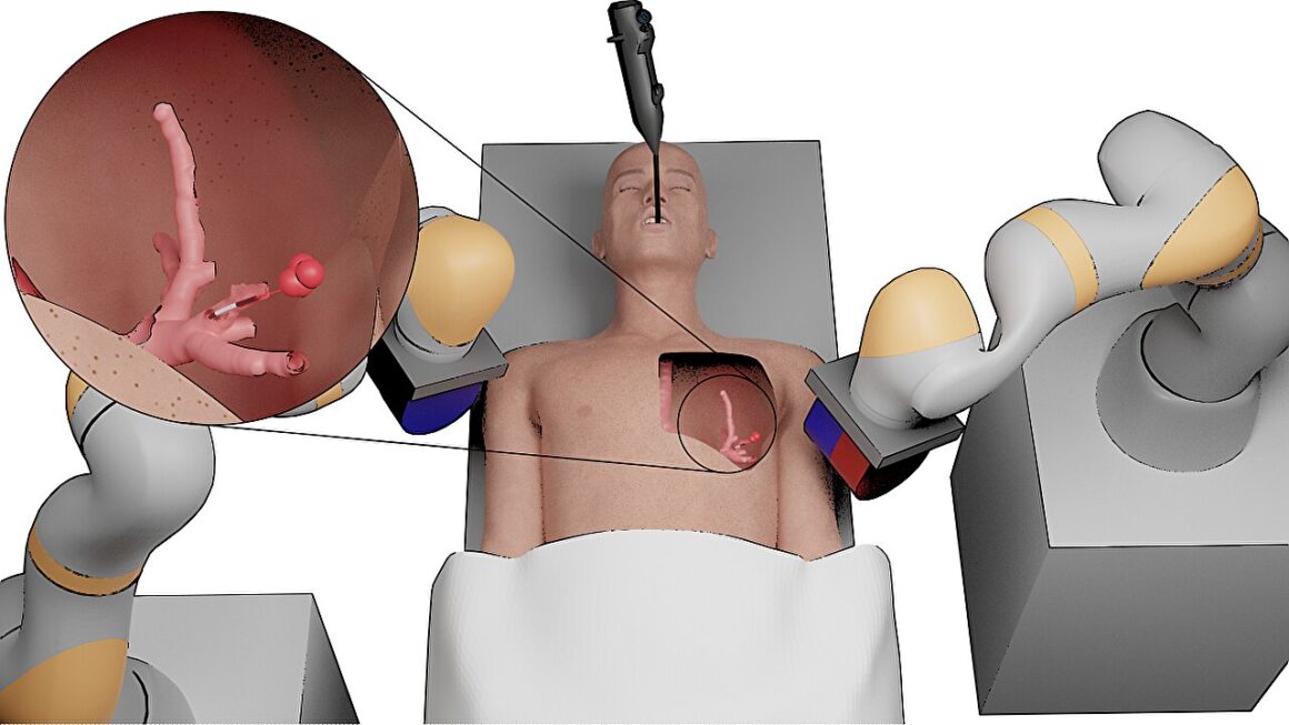 cancer.jpg VIDEO. Cancerul pulmonar, tratat de un mini robot. Cum arată dispozitivul dezvoltat de cercetătorii de la Universitatea din Leeds