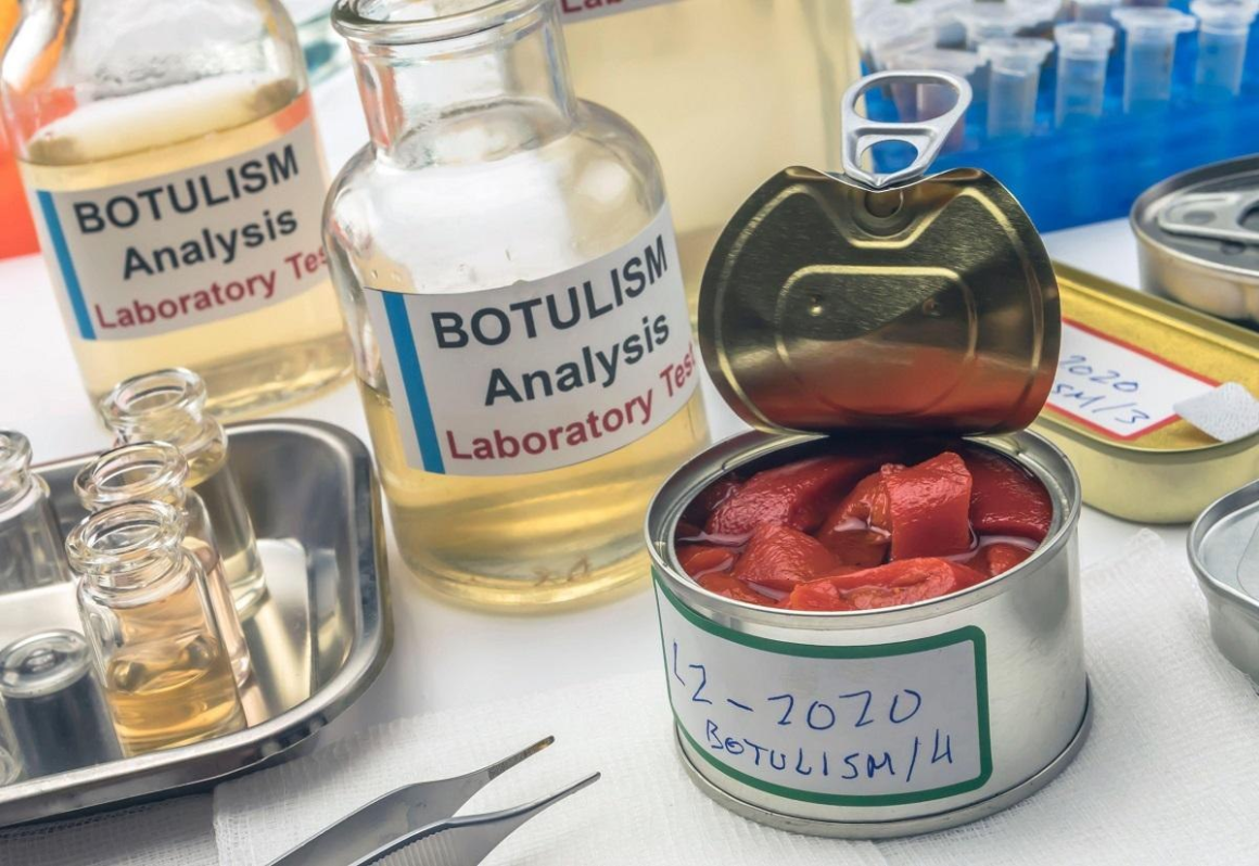 Cum ne ferim de botulism. Medic: „Este rară, dar mortală. Învățați să recunoașteți primele simptome!“