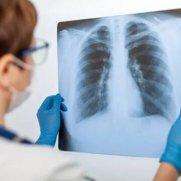 1706414697_index.jpeg Avertismentul unui medic: „Cel puţin în fiecare oră, un român moare de cancer”