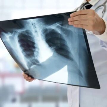 1719110116_index.jpeg Care sunt generațiile mai predispuse la cancer comparativ cu părinții și bunicii. Medic, despre avantajele în lupta cu maladia