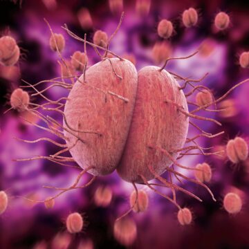 1723712387_index.jpeg Bacteria care transmite o boală sexuală ar putea deveni de netratat în viitor. „Va fi mai rezistentă la medicamente”