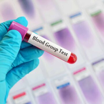 blood-group-test.jpg Cercetătorii au descoperit o grupă de sânge. Cât de rară e MAL