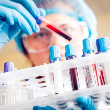 Cercetătorii au descoperit un nou tip de celule cerebrale