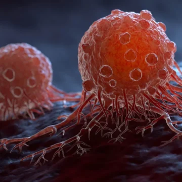 Un nou tratament cu anticorpi face cancerul să dispară complet