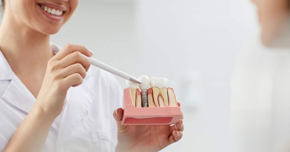 5 Mituri despre implantul dentar pe care ar trebui să le uiți